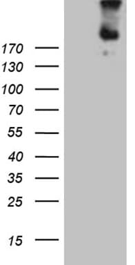 FLT4 / VEGFR3 Antibody (aa1063-1363, clone OTI9G6)