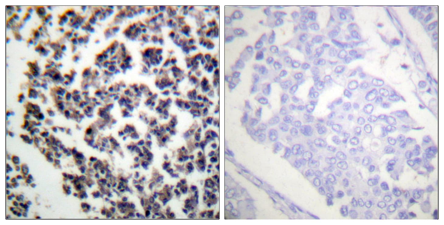 BLNK Antibody (phospho-Tyr96)