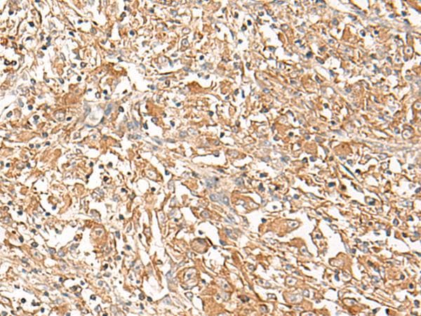 Polyclonal Rabbit anti-Human CORO2A Antibody (IHC)
