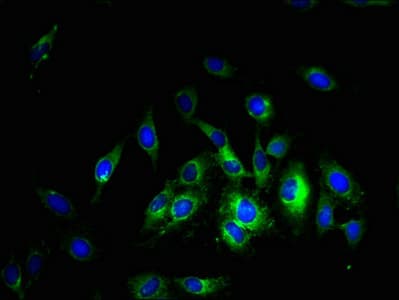 SLC38A5 Antibody
