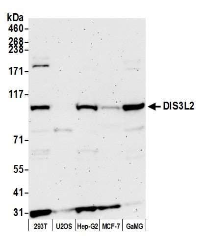 Polyclonal Rabbit anti-Human DIS3L2 Antibody (aa475-525, WB)