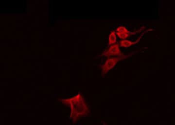 ADAMTS19 Antibody