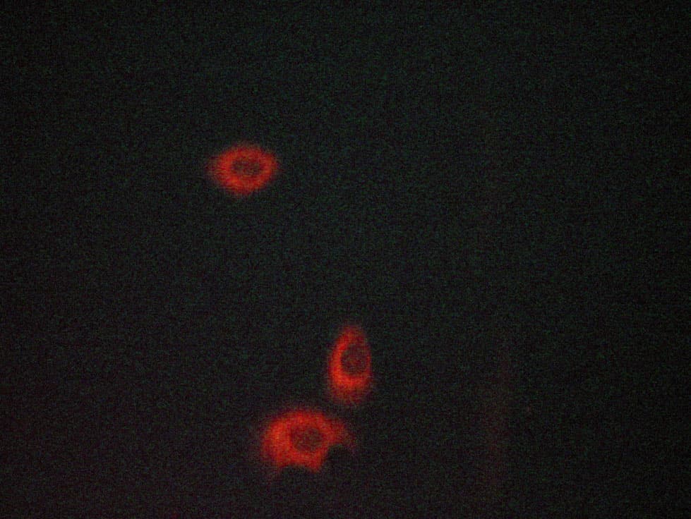 NFKBIA / IKB Alpha / IKBA Antibody