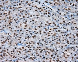 DAPK2 / DAP Kinase 2 Antibody (clone OTI1F7, Carrier-free)