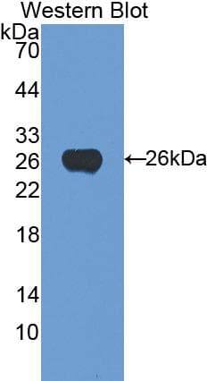 CD71 / Transferrin Receptor Antibody (aa587-756)