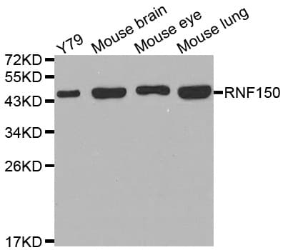 Polyclonal Rabbit anti-Human RNF150 Antibody (WB)