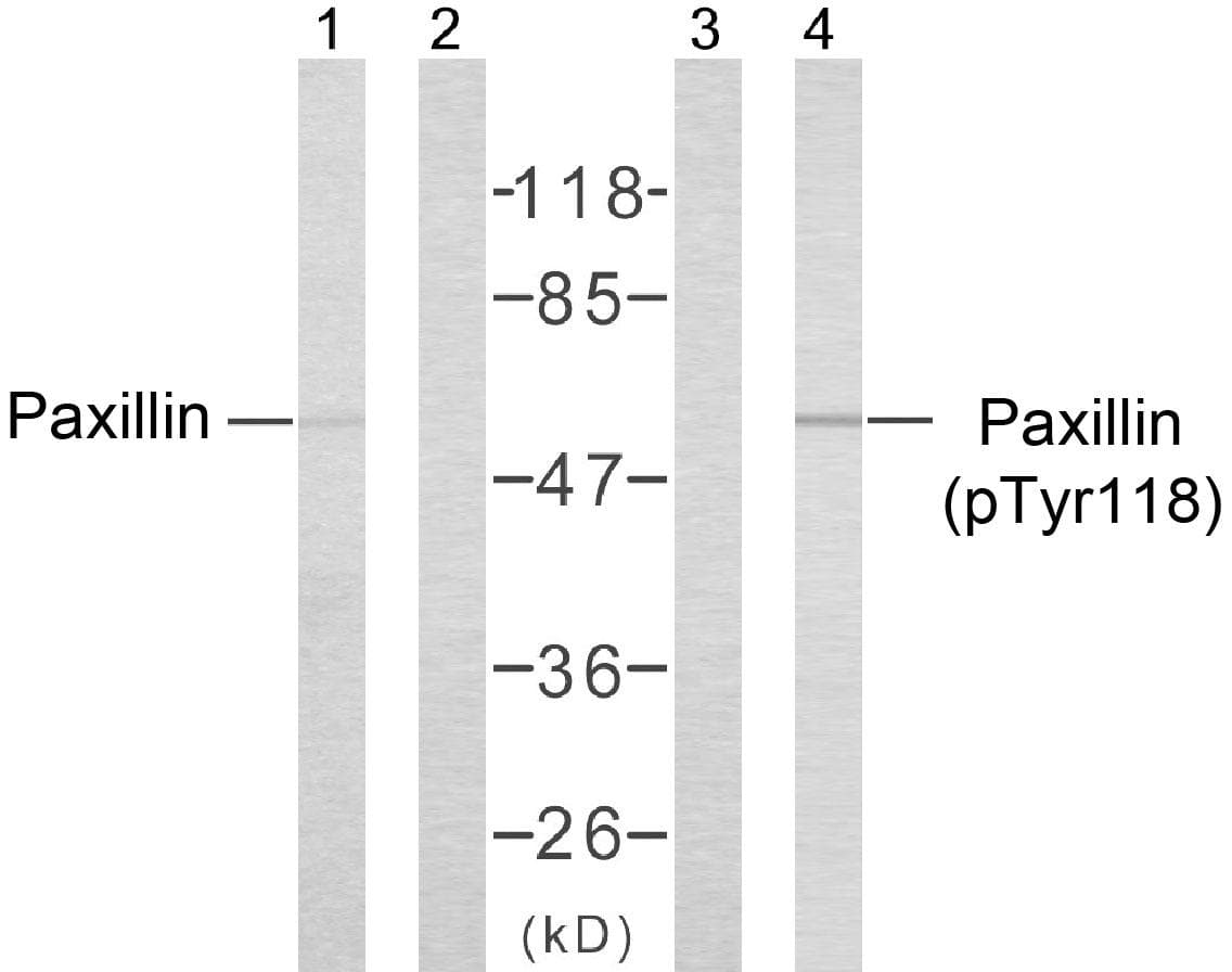 Polyclonal Rabbit anti-Human PXN / Paxillin Antibody (p118, IHC, WB)
