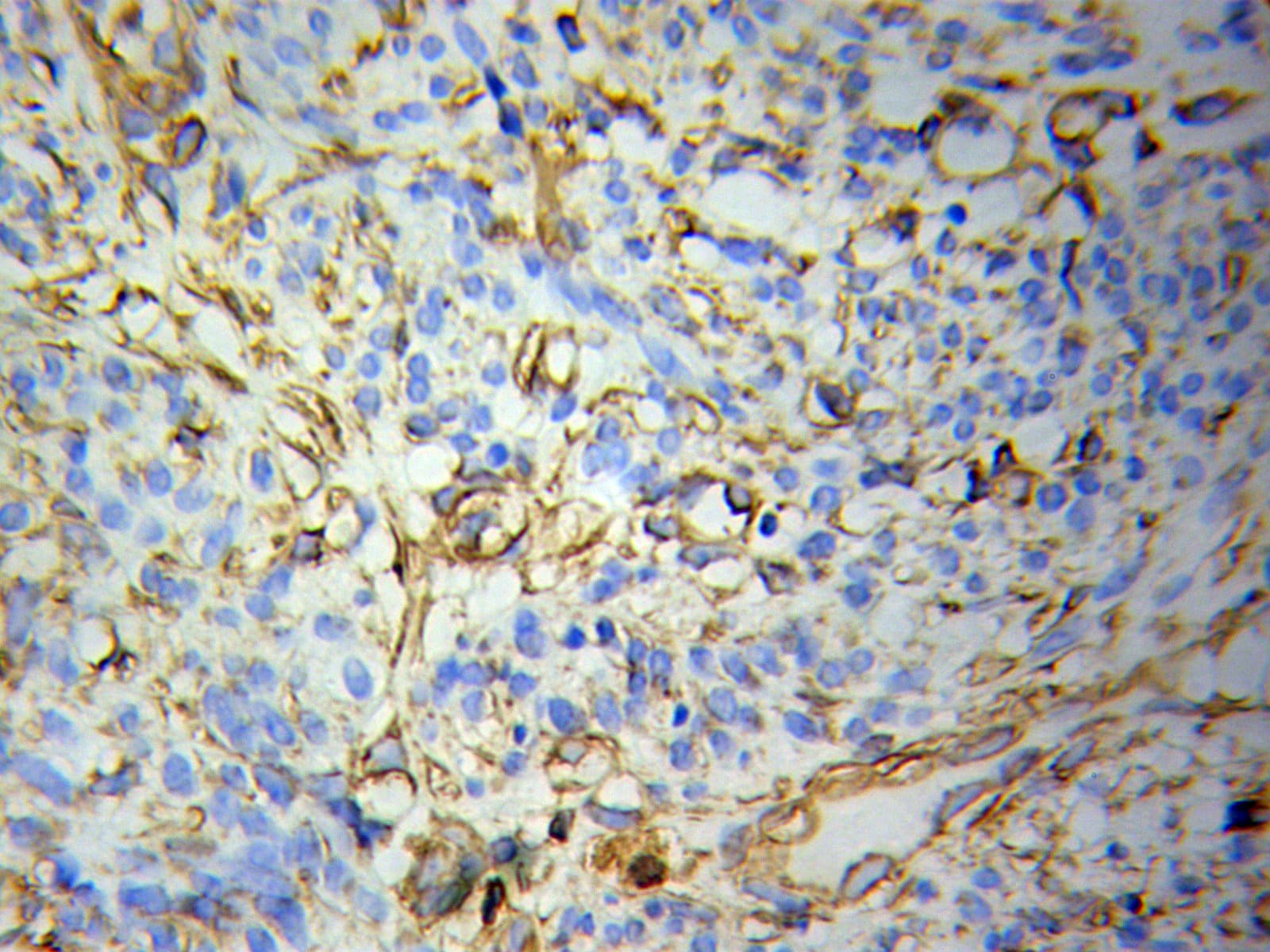 Polyclonal Rabbit anti-Human POLR1C / RPA39 Antibody (IHC, WB)