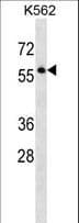 SEPT8 / Septin 8 Antibody (aa407-436)