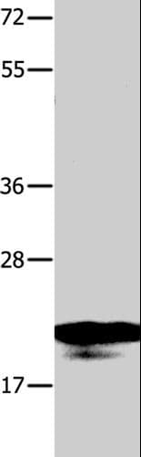 Polyclonal Rabbit anti-Human NME1 / NM23 Antibody (WB)