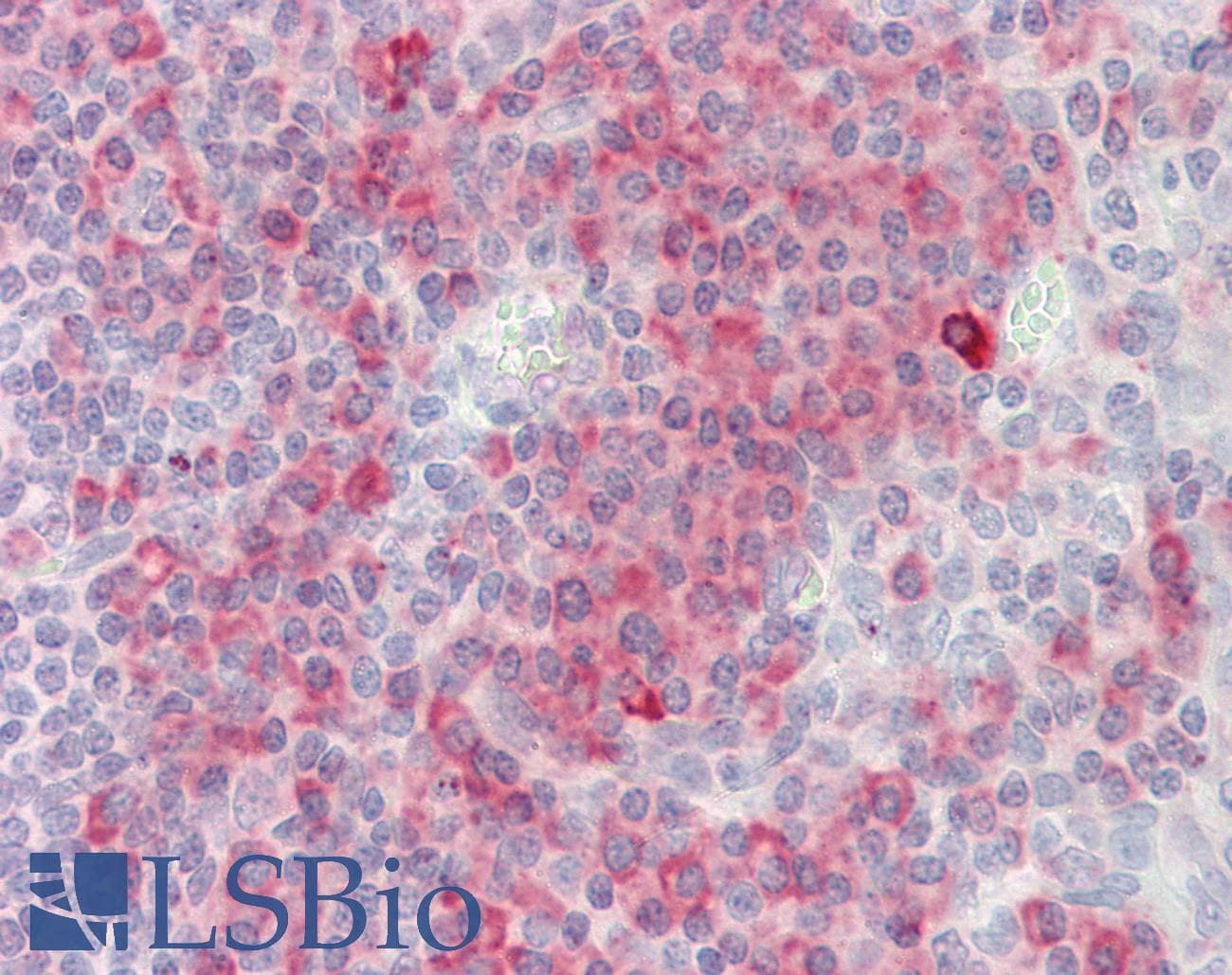 SH2D1A / SAP Antibody (C-Terminus)