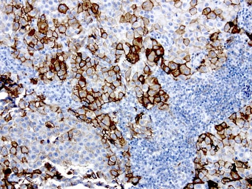 MCAM / CD146 Antibody (clone UMAB154)