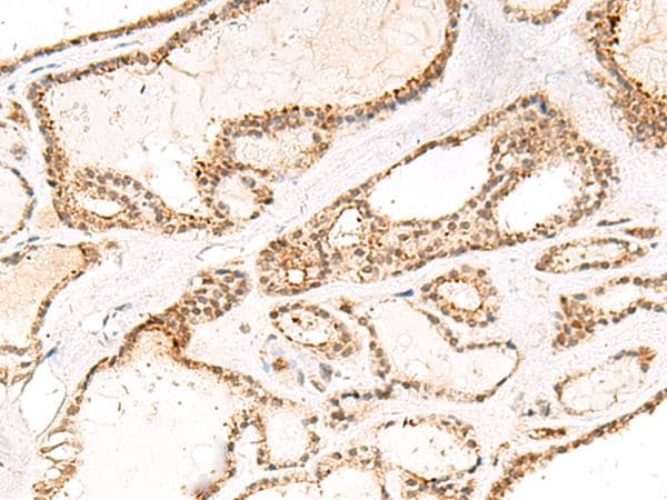 DCAF10 Antibody
