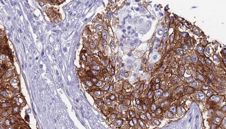 CD46 Antibody