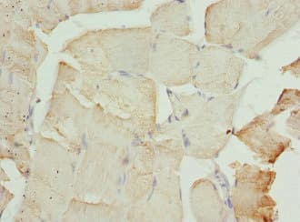CFL2 / Cofilin 2 Antibody