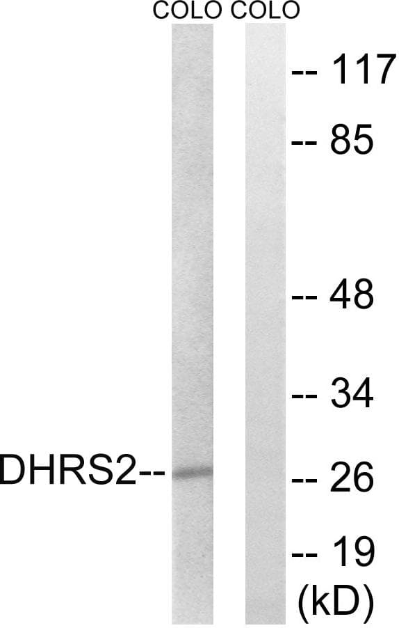 Polyclonal Rabbit anti-Human DHRS2 / HEP27 Antibody (WB)