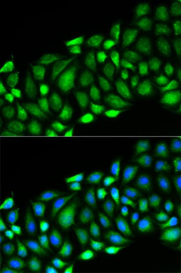 RICK / RIP2 Antibody