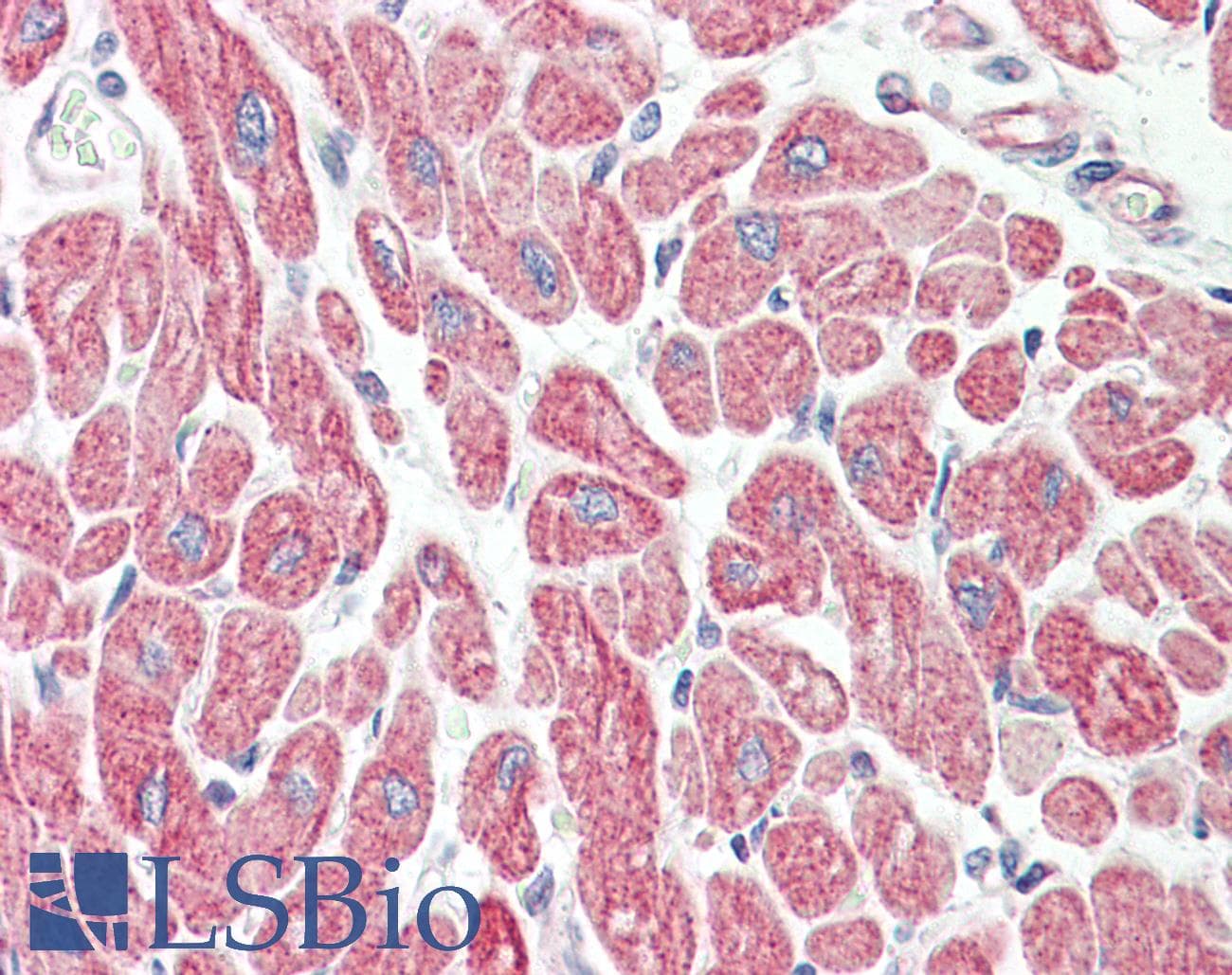 IHC-plus™ AK1 / Adenylate Kinase 1 Antibody (aa101-150)