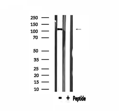 COL6A2 / Collagen VI Alpha 2 Antibody