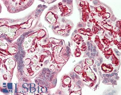 IHC-plus™ CTDP1 / FCP1 Antibody (aa911-961)