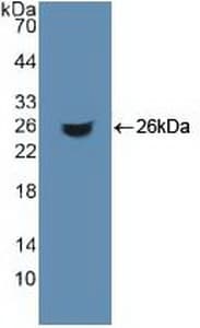 ACO1 / Aconitase Antibody (aa26-243, Biotin)