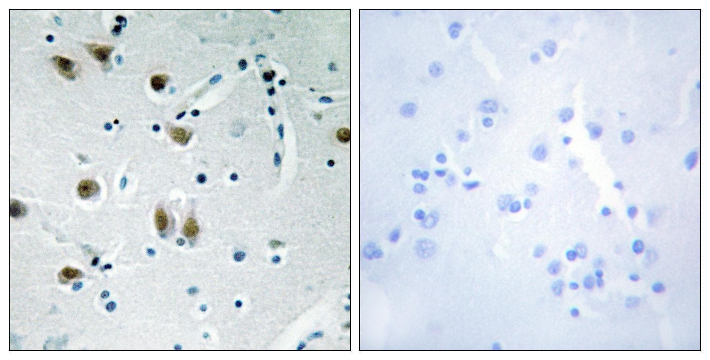 ZNF148 / ZBP-89 Antibody