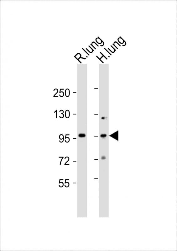 MED15 / ARC105 Antibody (aa743-779)
