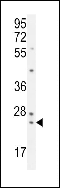 ZG16B Antibody (aa 109-137, Internal)
