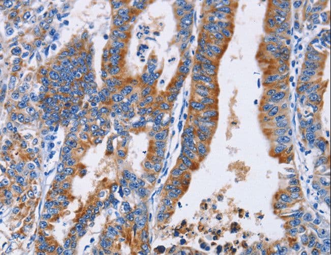 Polyclonal Rabbit anti-Human ANXA4 / Annexin IV Antibody (IHC, WB)