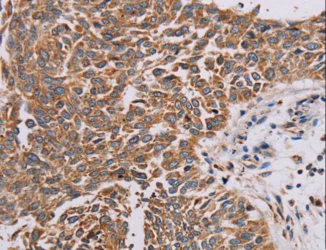 PLEKHG6 Antibody