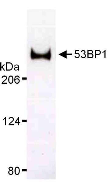 TP53BP1 / 53BP1 Antibody (aa1925-C-term)