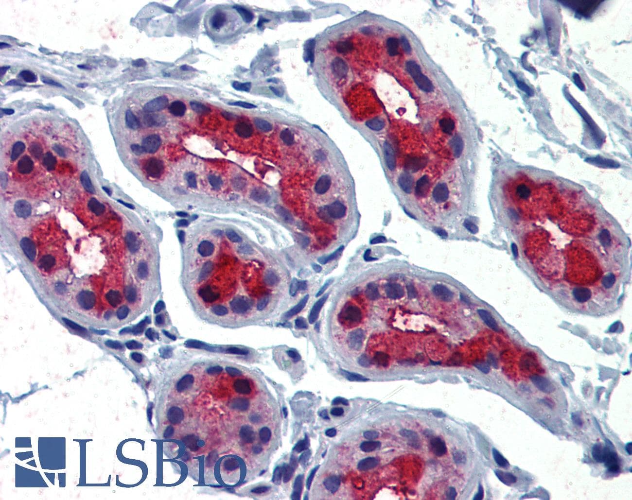 IHC-plus™ TSH Receptor / TSHR Antibody (C-Terminus)