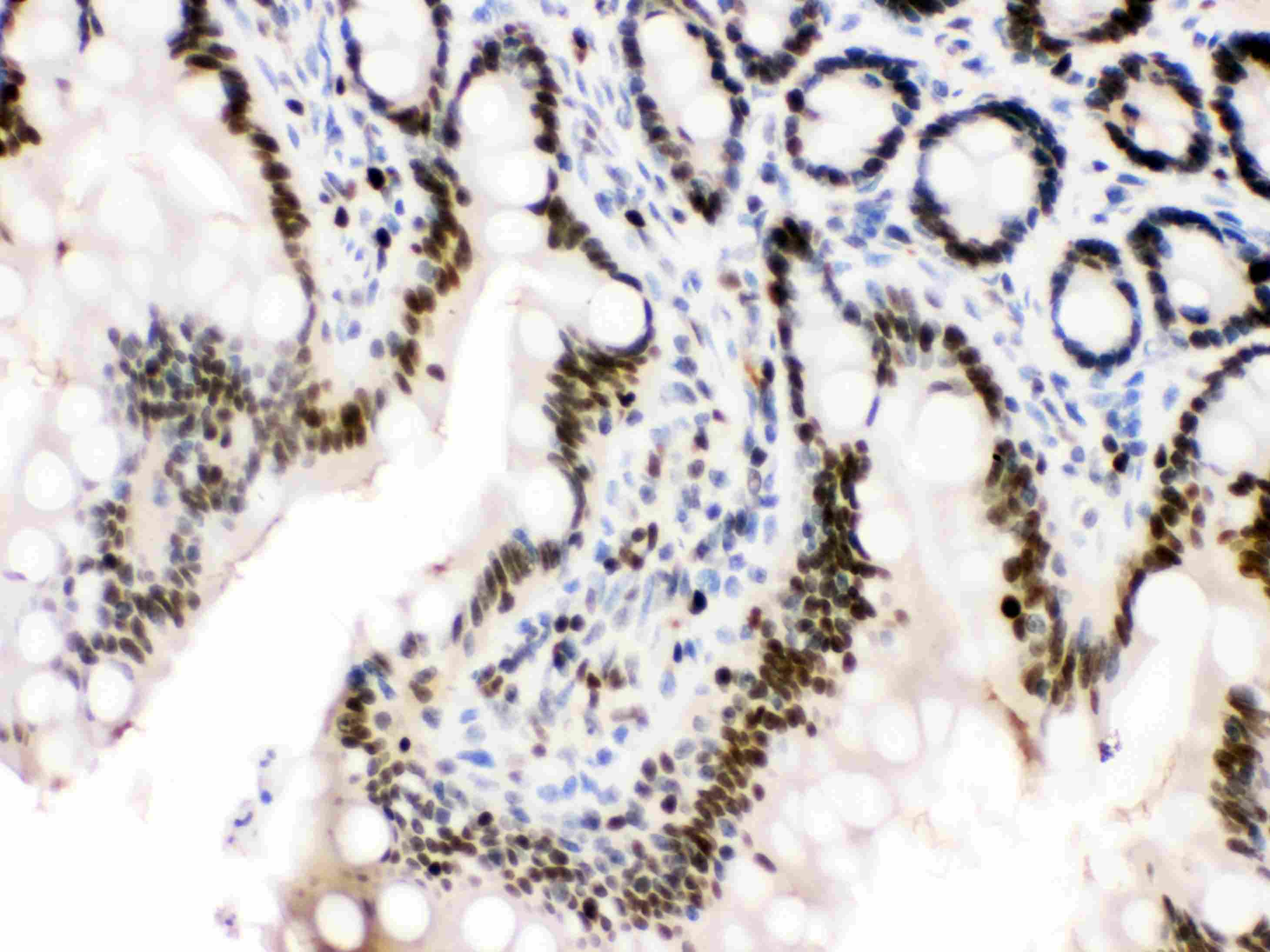 MCM3 Antibody (aa13-27)