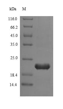 Human TERT / Telomerase Protein (Recombinant 6His, N-terminus)