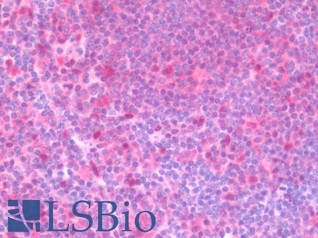 IHC-plus™ VCP Antibody (aa1-206)