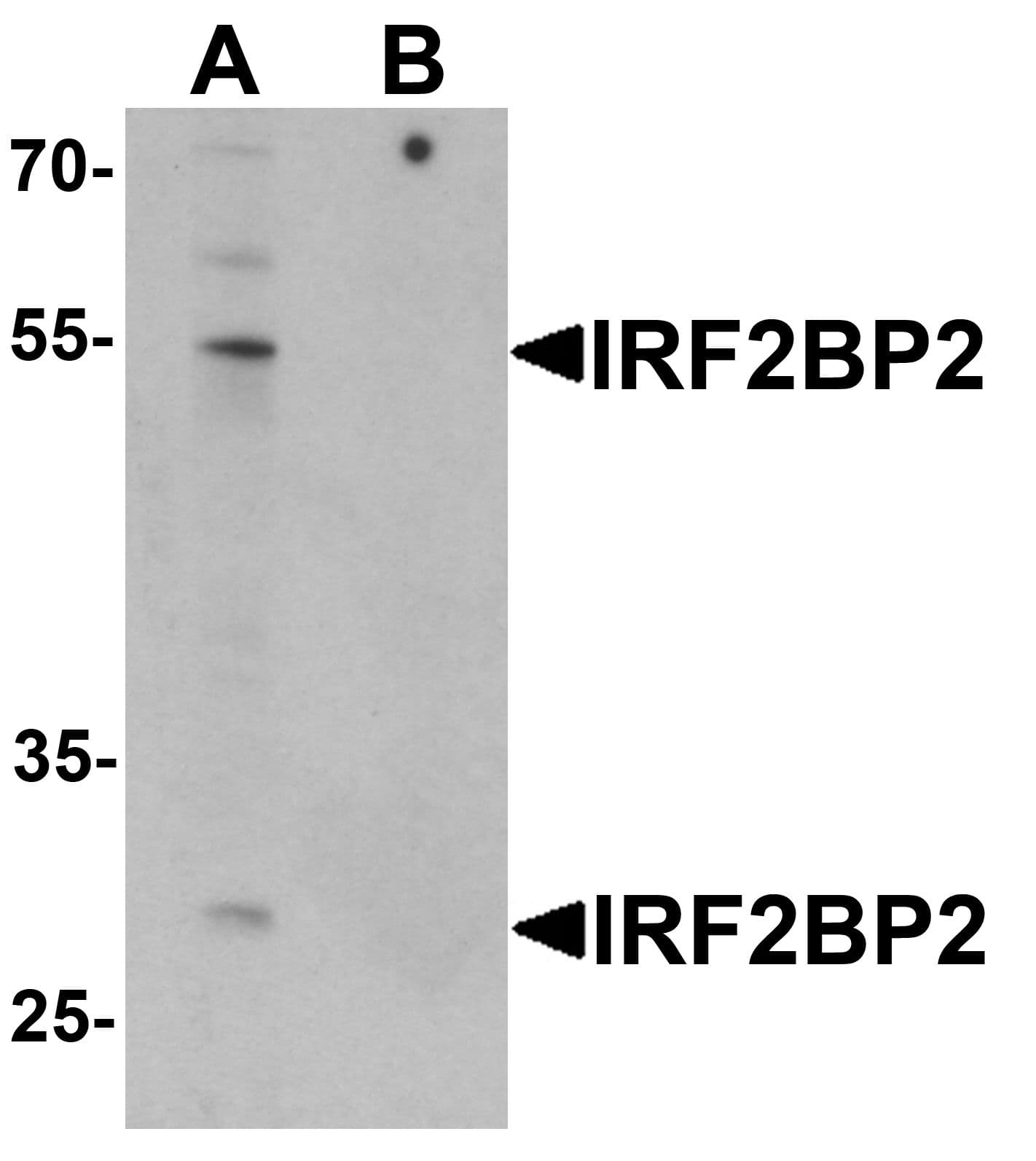 Polyclonal Rabbit anti-Human IRF2BP2 Antibody (WB)