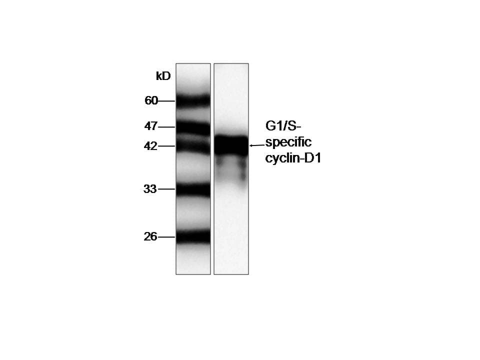 Monoclonal Mouse anti-Human CCND1 / Cyclin D1 Antibody (WB)