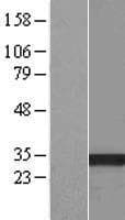 HSD17B13 Protein (Over-Expression Lysate Myc-DDK (Flag))
