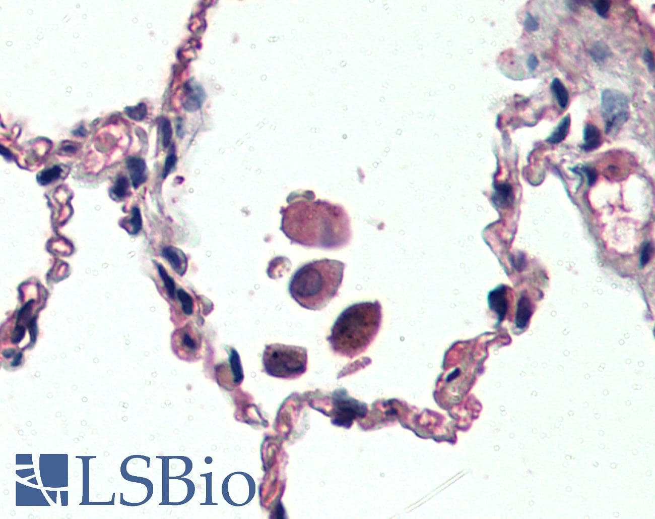 IHC-plus™ Polyclonal Goat anti-Human UCP2 Antibody (aa101-113, IHC, IF, WB)