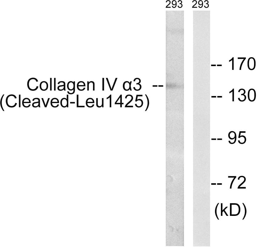 Polyclonal Rabbit anti-Human COL4A3 / Tumstatin Antibody (Cleaved-Leu1425, WB)