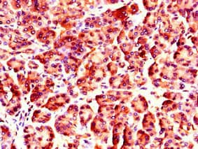 NUP85 / Pericentrin 1 Antibody