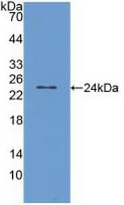 VR1 / TRPV1 Antibody (aa1-153)