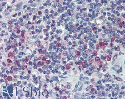 IHC-plus™ Polyclonal Rabbit anti-Human CARMA1 / CARD11 Antibody (aa1104-1154, IHC, WB)