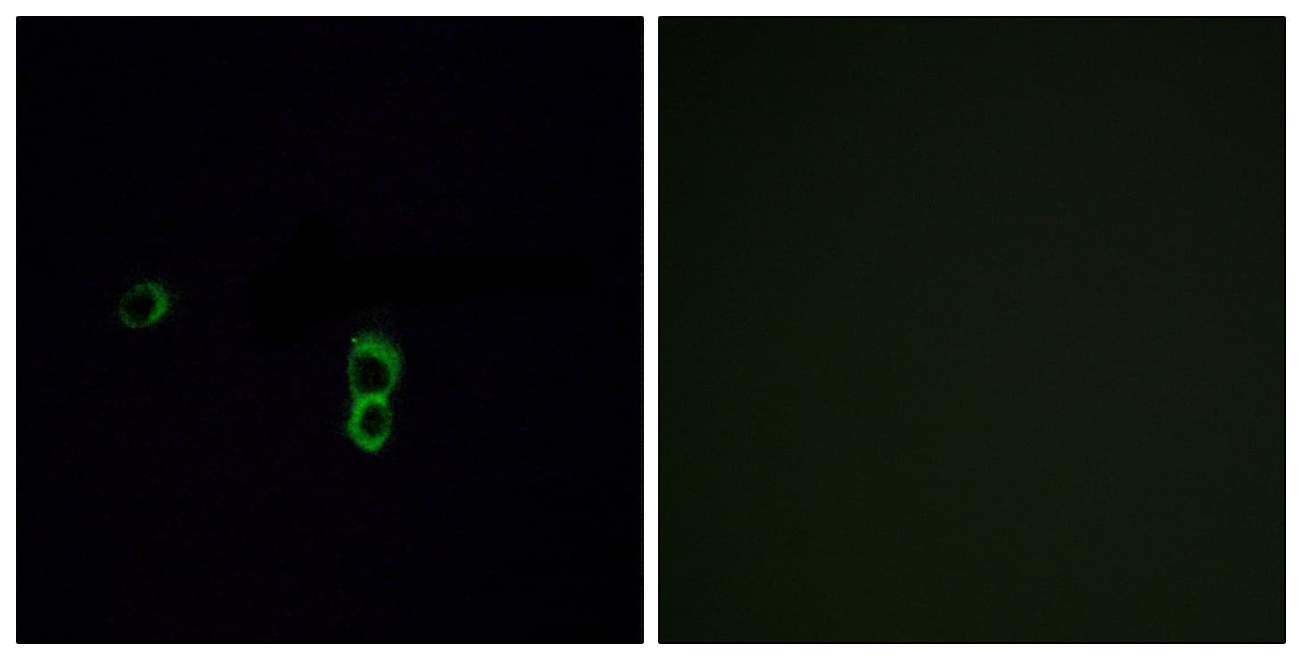 OR9Q1 Antibody (aa234-283)