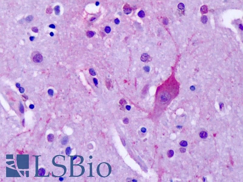IHC-plus™ Polyclonal Rabbit anti-Human GRM4 / MGLUR4 Antibody (C-Terminus, IHC)