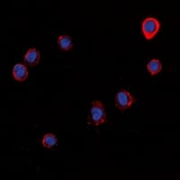 Polyclonal Rabbit anti-Human HRH1 / Histamine H1 Receptor Antibody (Internal, IF, WB)