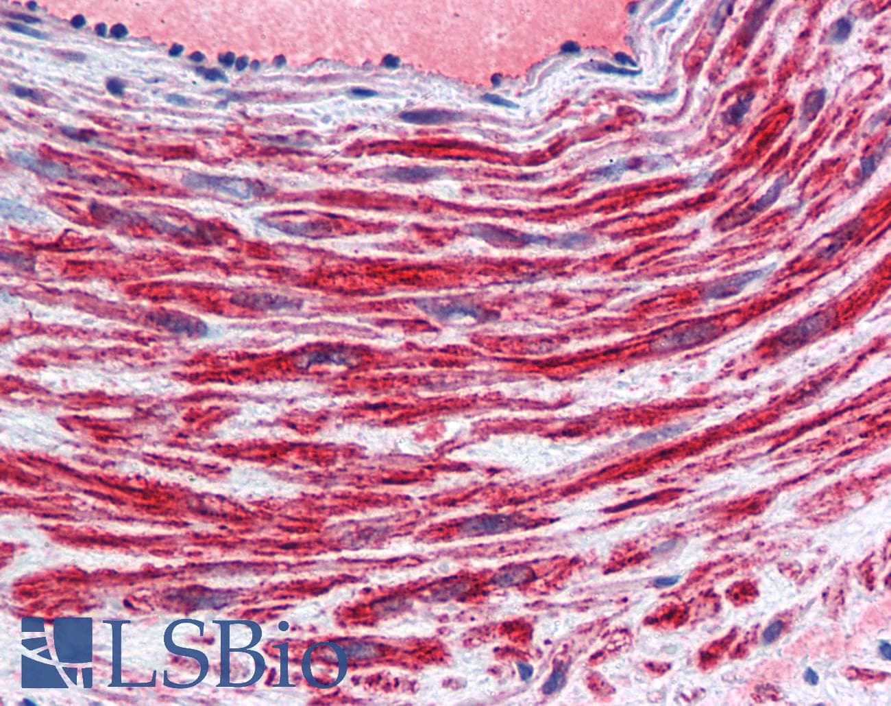 IHC-plus™ TFPI / LACI Antibody