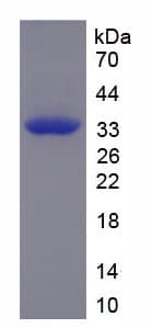 Human Calcitonin Protein (Recombinant His-GST)