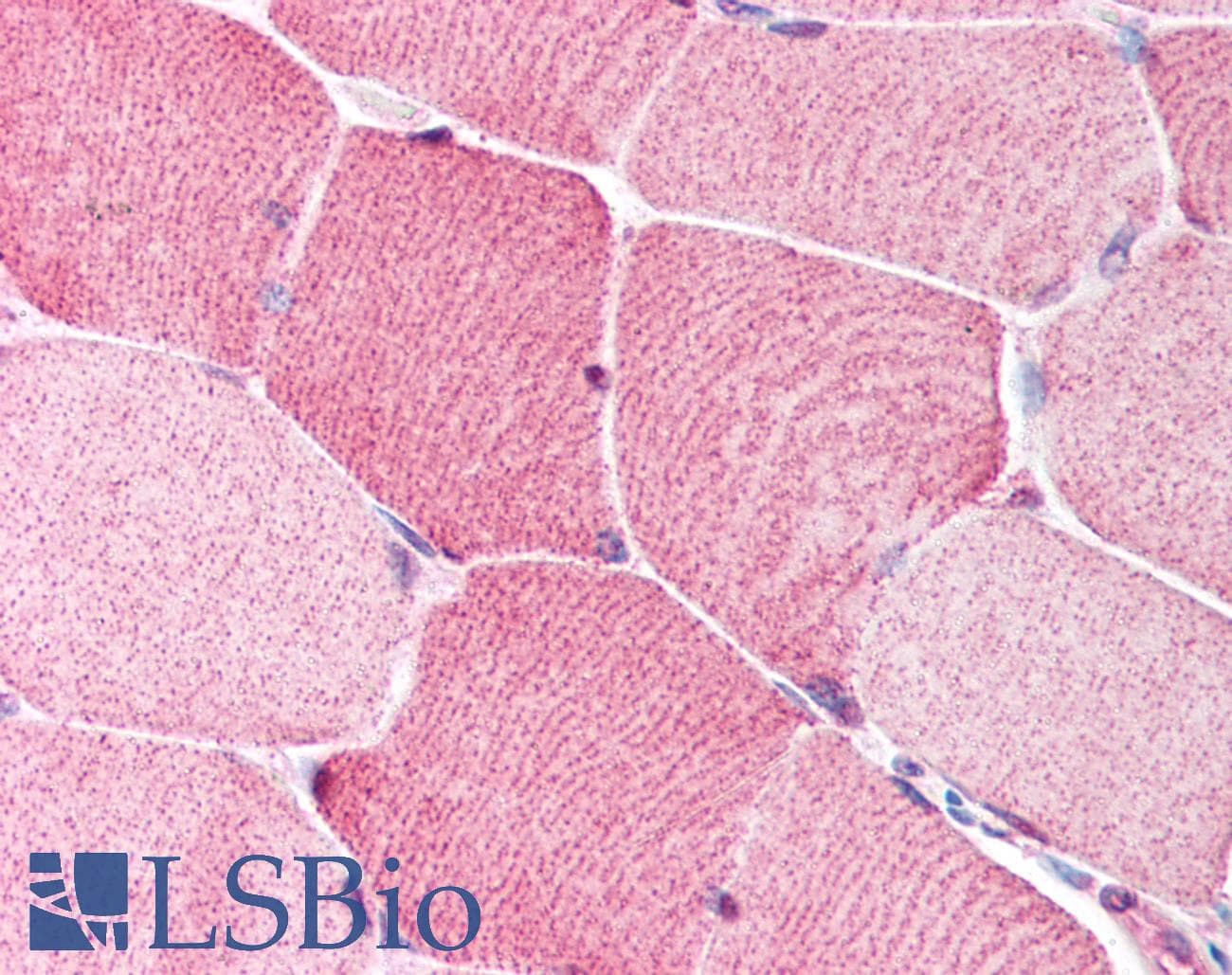 IHC-plus™ BRCC3 / BRCC36 Antibody