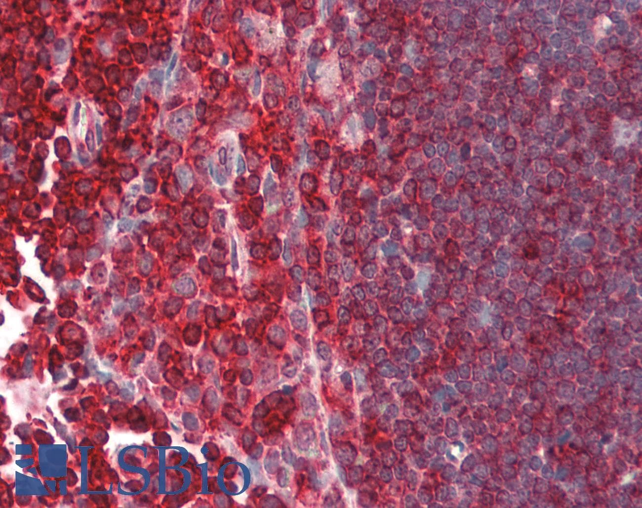 IHC-plus™ DHPS Antibody (aa51-100)